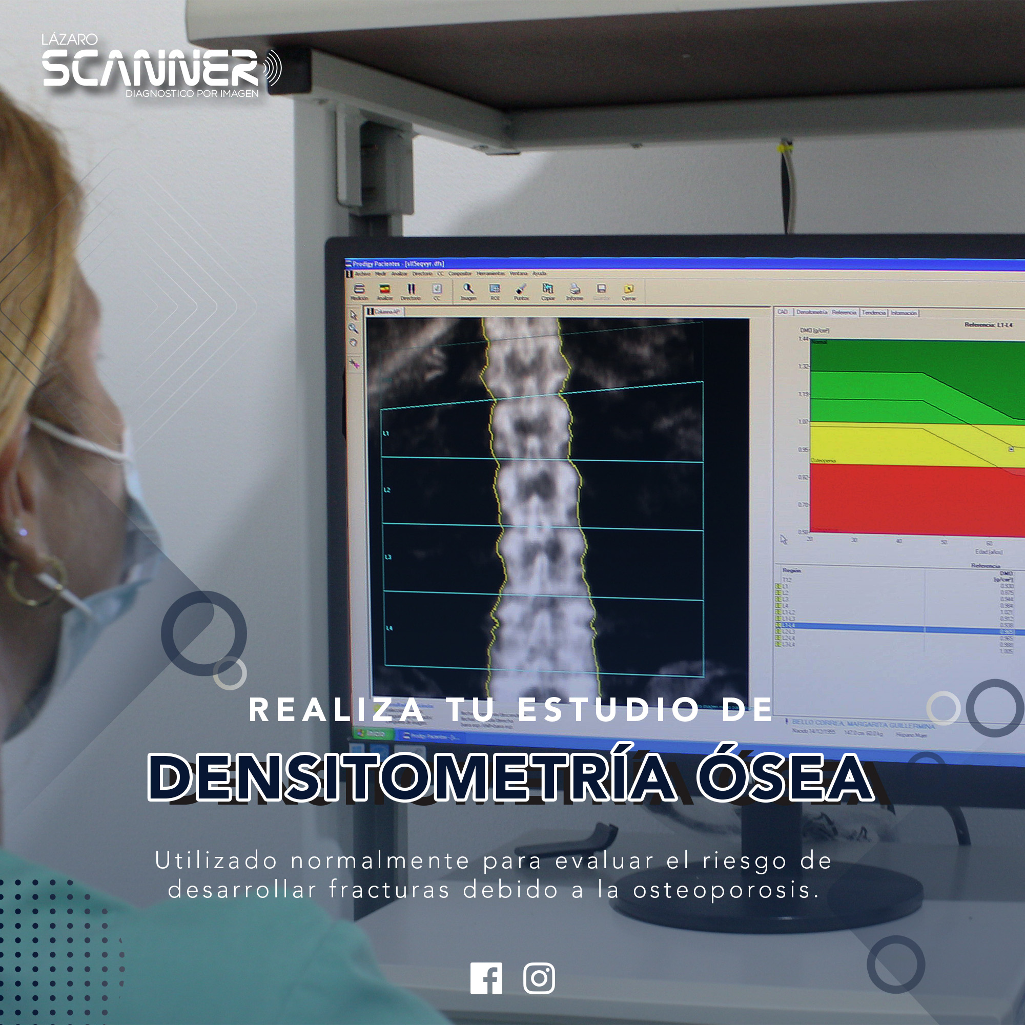 Servicio de Densitometría