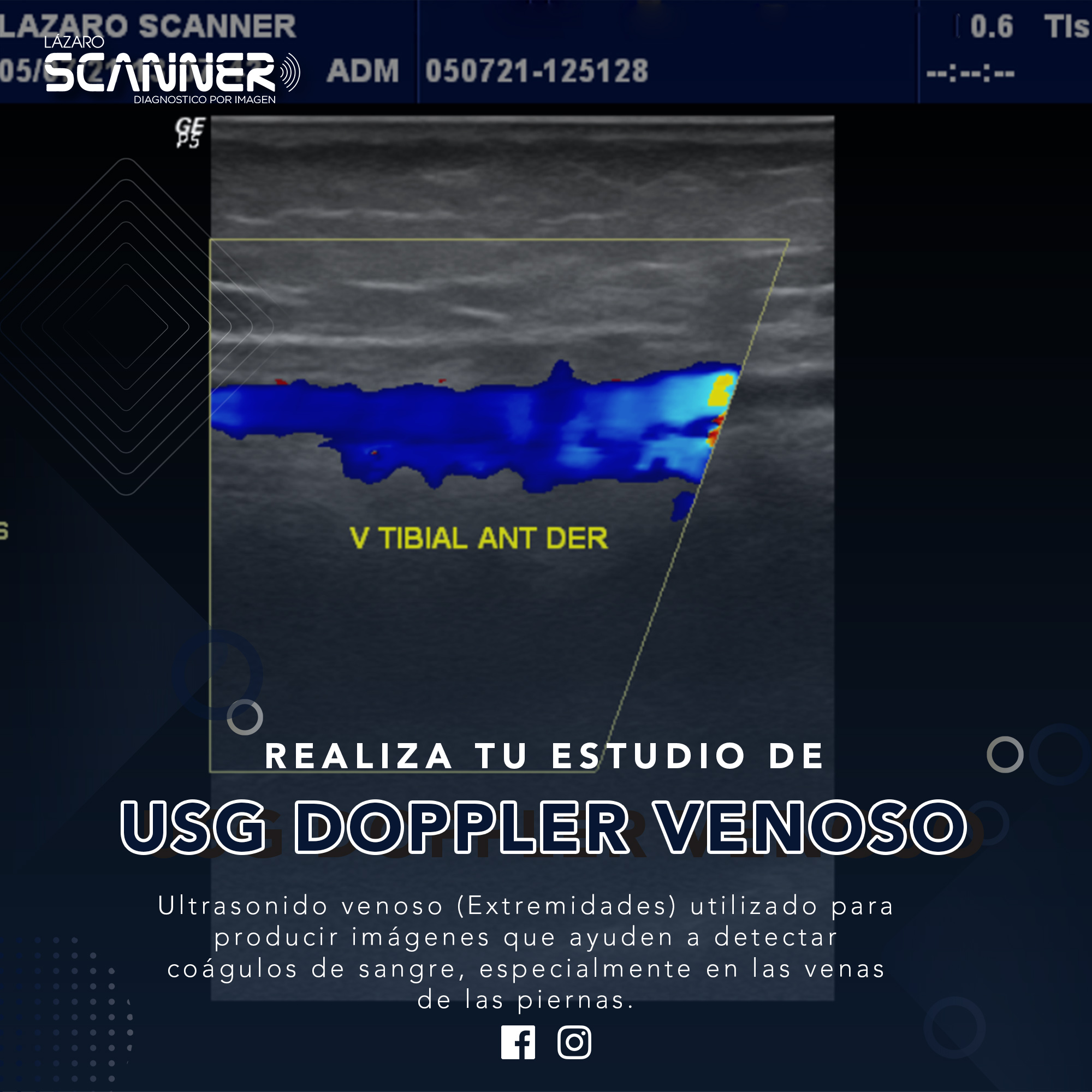 Ultrasonido Doppler Venoso