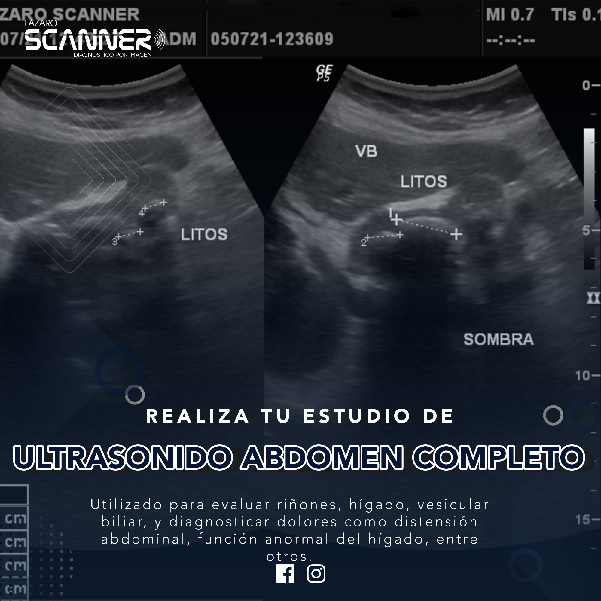 Ultrasonido Abdomen Completo