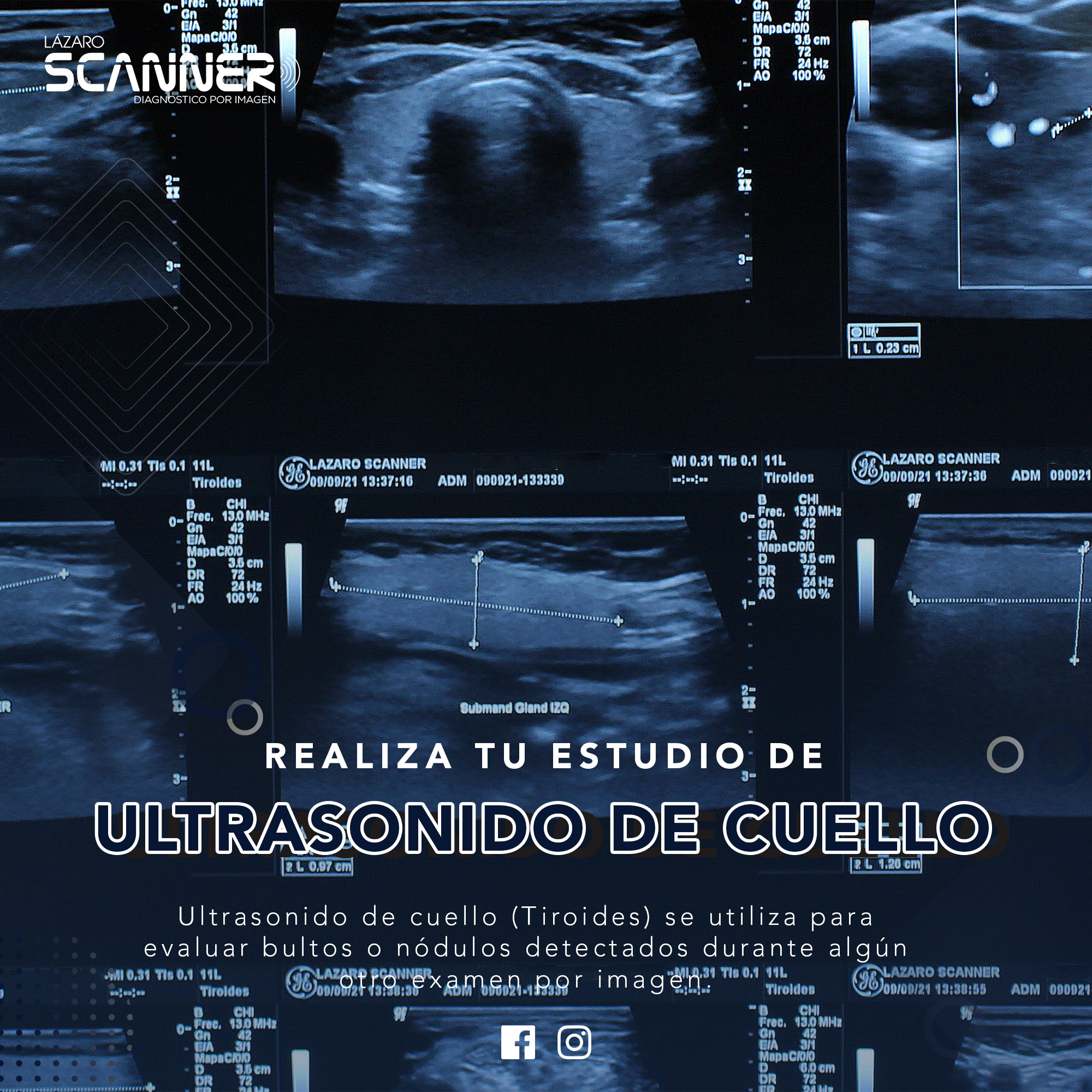 Ultrasonido de Cuello